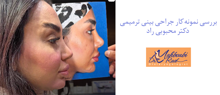 بررسی نمونه کار جراحی بینی ترمیمی دکتر محبوبی راد 