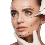 جراحی فیس لیفت
