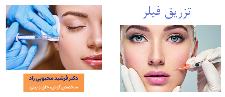 درباره تزریق فیلر 