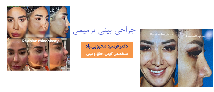درباره جراحی بینی ترمیمی