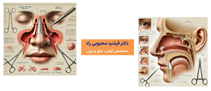 آشنایی با عمل ترمیم سوراخ بینی 