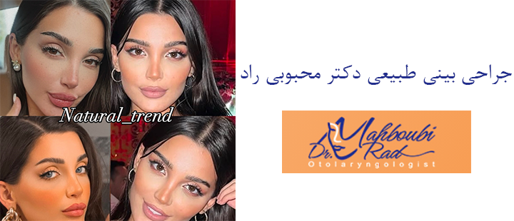 جراحی بینی طبیعی دکتر محبوبی راد 