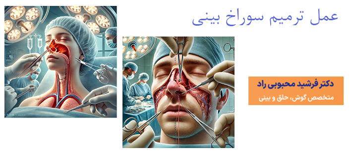 درباره عمل ترمیم سوراخ بینی 
