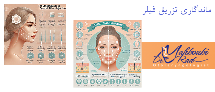 درباره ماندگاری تزریق فیلر