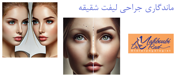 درباره ماندگاری جراحی لیفت شقیقه