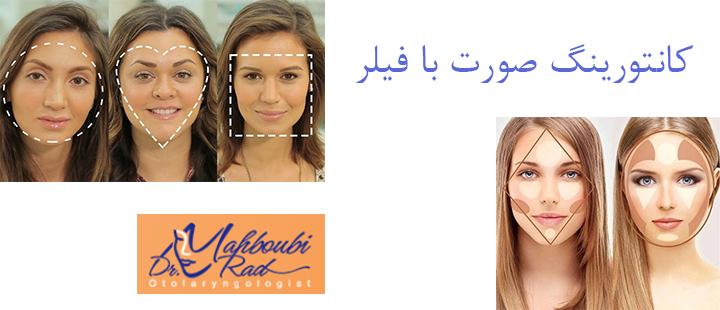 درباره کانتورینگ صورت با فیلر 