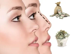 هزینه جراحی بینی