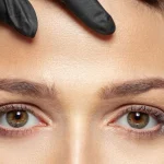 هزینه جراحی لیفت شقیقه