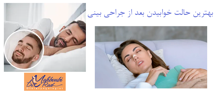 درباره بهترین حالت خوابیدن بعد از جراحی بینی 