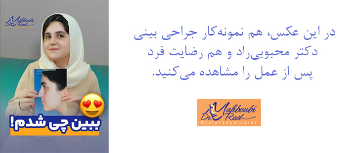 رضایت زیباجو بعد از عمل