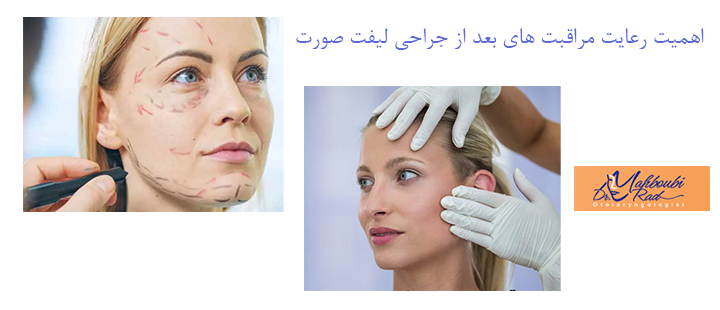 اهمیت رعایت مراقبت های بعد از جراحی لیفت صورت