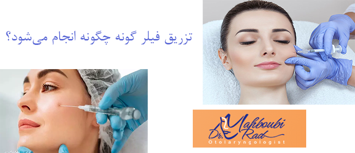 تزریق فیلر گونه چگونه انجام می‌شود؟