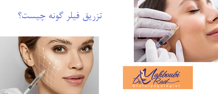 تزریق فیلر گونه چیست؟