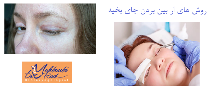 روش های از بین بردن جای بخیه 