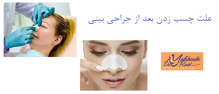 علت چسب زدن بعد از جراحی بینی 