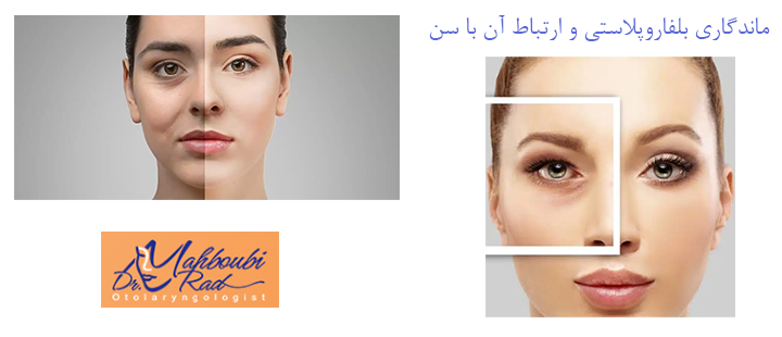 ماندگاری بلفاروپلاستی و ارتباط آن با سن