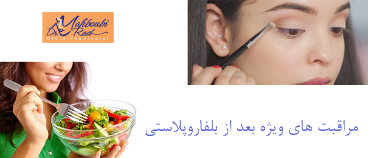 مراقبت های ویژه بعد از بلفاروپلاستی