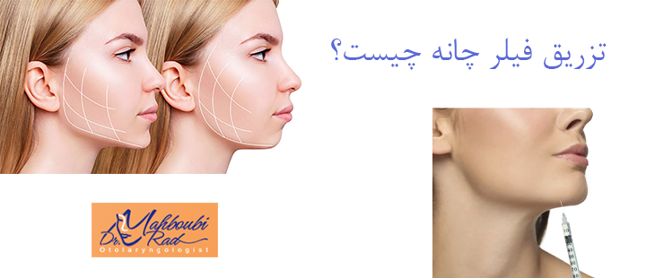 درباره تزریق فیلر چانه 