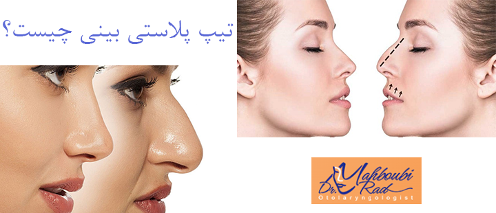 تیپ پلاستی بینی چیست؟