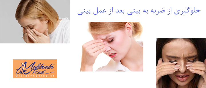جلوگیری از ضربه به بینی بعد از عمل بینی