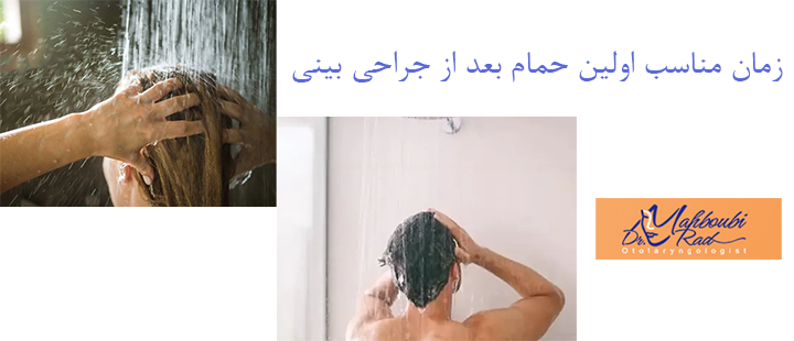زمان مناسب اولین حمام بعد از جراحی بینی