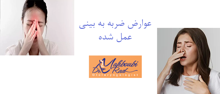 عوارض ضربه به بینی عمل شده 