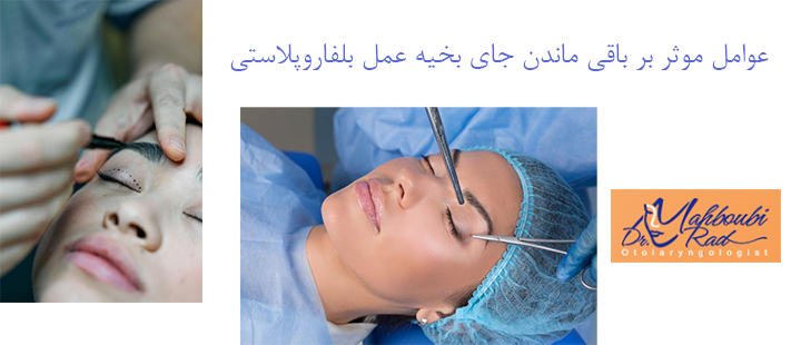 عوامل موثر بر باقی ماندن جای بخیه عمل بلفاروپلاستی