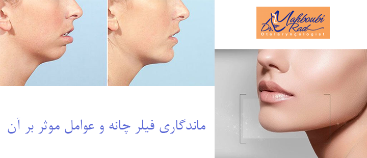 ماندگاری فیلر چانه 
