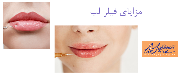 مزایای فیلر  لب 