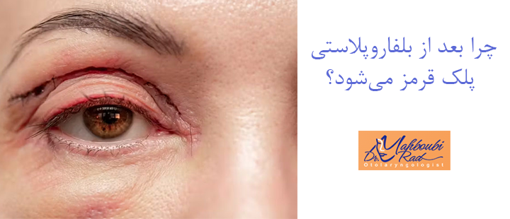 چرا بعد از بلفاروپلاستی پلک قرمز می‌شود؟