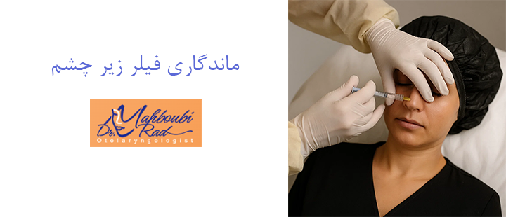 ماندگاری فیلر زیر چشم 