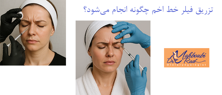 نحوه تزریق فیلر خط اخم 