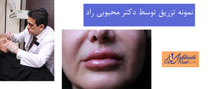 نمونه تزریق توسط دکتر محبوبی راد 